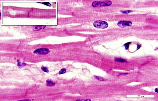 10. (UFRN) Durante a respiração, quando o diafragma se contrai e desce, o volume da caixa torácica aumenta, por conseguinte a pressão intrapulmonar: a) diminui e facilita a entrada de ar.