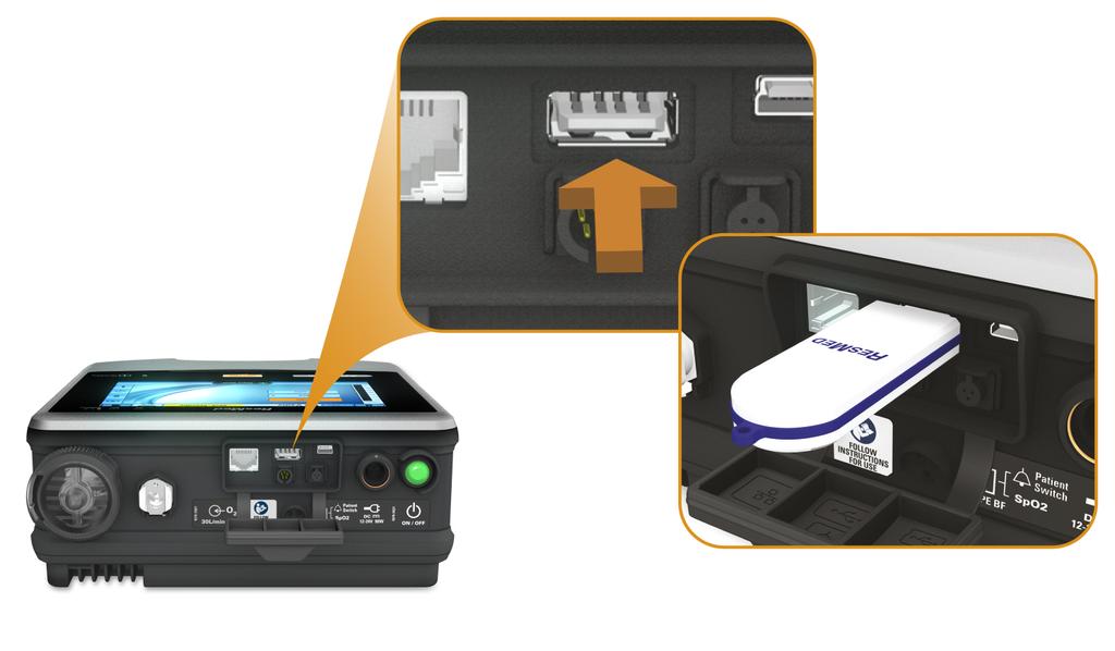 Processo de gestão de dados Processo de gestão de dados Os dados da monitorização do dispositivo Astral podem ser visualizados no software de gestão de pacientes ResScan.