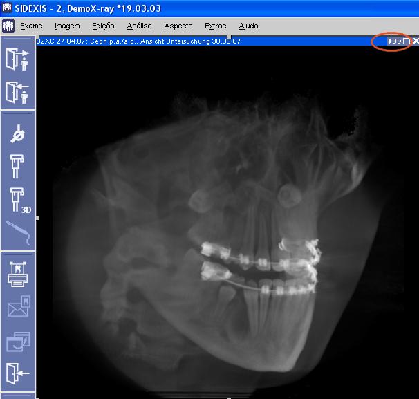 Sirona Dental Systems GmbH Manual de instruções dos componentes do software GALILEOS / ORTHOPHOS XG 3D 3 Criação de radiografias 3D 3.2 Realizar a captura de imagens 3.