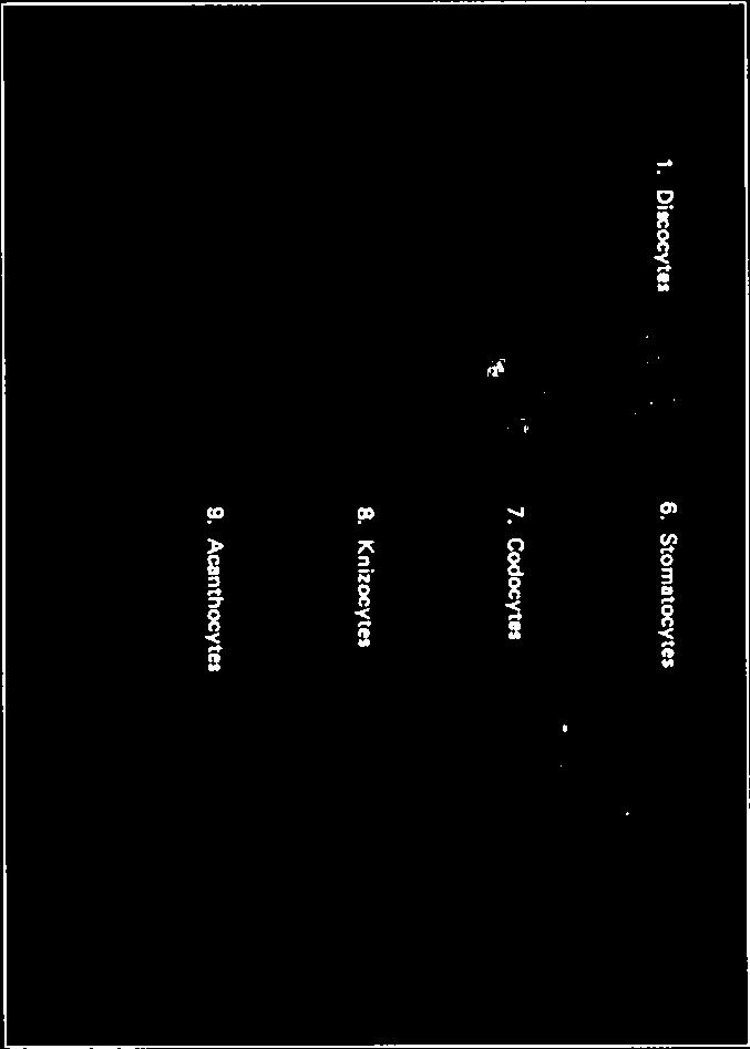 Codocito; Estomatocito; Esquiso cito; Células fantasma e Acantocito4 5 (Figura 1). 1. Di.~o~yt.~ 6. Stom~to~yte, 2. Echinocyte$ - 7. Godo~Vt.. 3. An~Io~yte~ a Kni~o~yte, 4. GS0W - 5. Schi~ocyt.s 9.