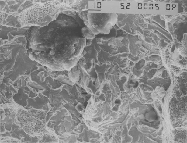 Figura 12 - Microestrutura após normalização dentro da zona crítica. 500x.