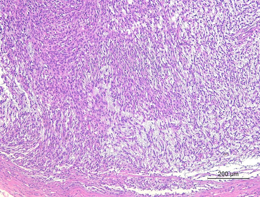 B.C. Martins, G.C. Martins, R.S. Horta, et al. 2015. Aspectos clínico-patológicos da neoplasia da bainha de mielina no plexo braquial com infiltração do canal medular em um cão.