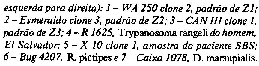 Souza MA. Silveira l't. Miles MA. Póvoa MM. Lima JAN. Valente SAS. Epidemiologia de um caso de Doença de Chagas na Ilha do Mosqueir(}-Pará.