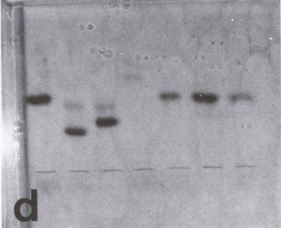 A captura e identificação de animais silvestres possibilitaram o isolamento de cepas de 7: cruzi, que foram caracterizados por eletroforese de