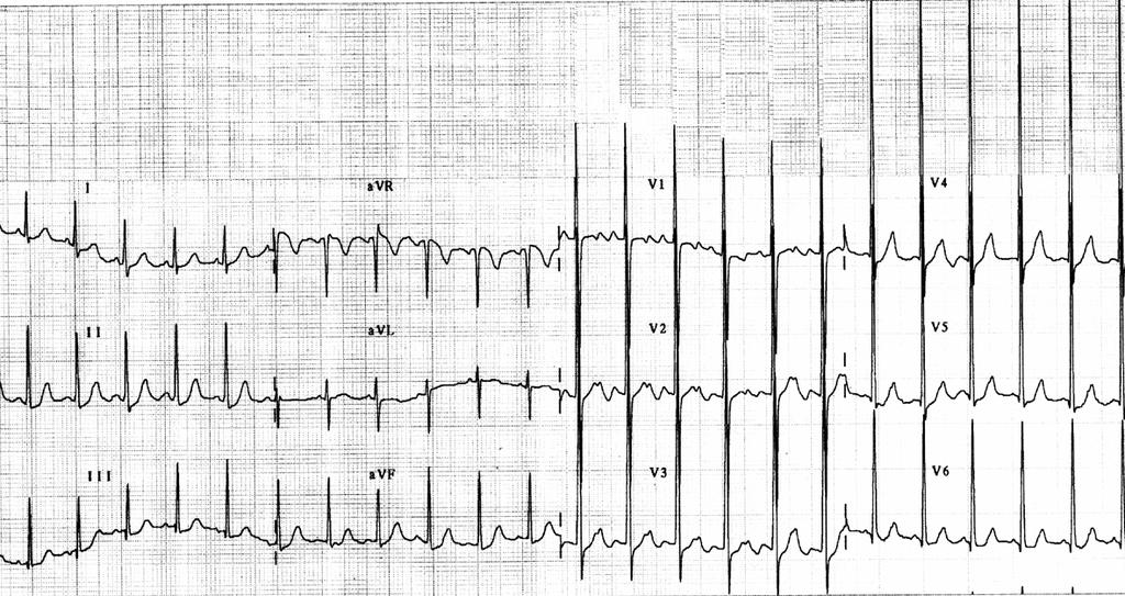 Nome: GAA. Idade: 2a. Sexo: F. Raça: B. Peso: 13Kg. Altura: 90cm. Número: 707 Data: 05/11/2001.