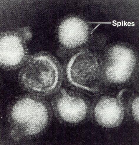 Potyvirus RÍGIDO