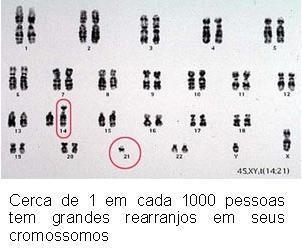 12 Figura 2 - Translocações Robertsonianas Fonte: