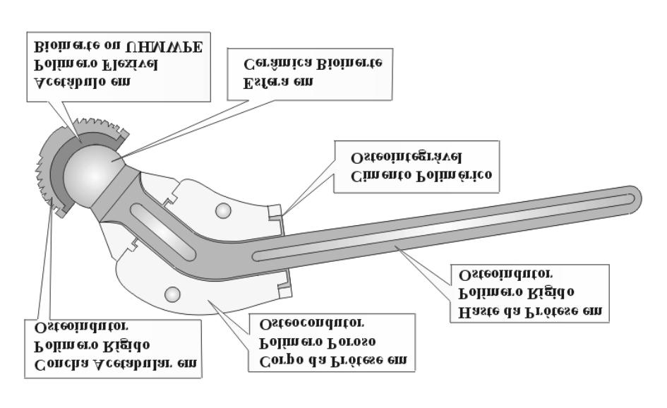 Fig. 1 Esquema da prótese completa de quadril em cerâmica e polímero. INGNÁCIO et al. - 1996], além de apresentarem características fisico-mecânicas similares às do osso.