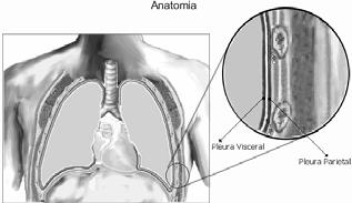 Doenças pleurais Doenças Pleurais Derrame pleural Empiema Pneumotórax Hemotórax Prof. Carlos Cezar I. S.