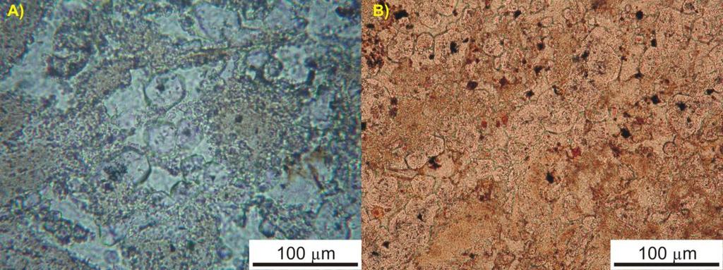 hidrotermais, com domínios subordinados de quartzo diagenético, de aspecto sujo e índice de refração inferior ao do quartzo detrítico, e menos de 5% de clastos terrígenos com dimensões menores que
