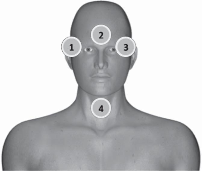 Figura 1. Posicionamento dos dosímetros no paciente. de órgãos radiossensíveis como a tireoide e os olhos.