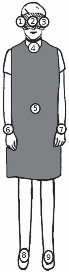 dosímetros 1, 2 e 3, respectivamente; um na região da tireoide fixado externamente sobre o protetor tireoidiano dosímetro 4; um na região do tórax, sob o avental dosímetro 5; dois para as mãos, na