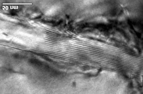 Além das imagens de reticulado das interfaces Cr 2 N/α, foram feitas imagens de melhor