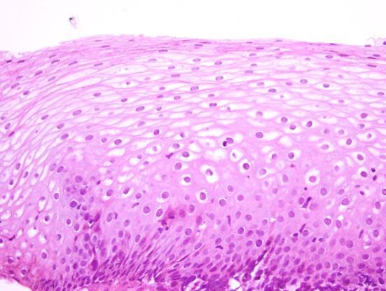 47 Figura 3 - Comparação entre cortes histológicos de epitélio esofágico com ênfase na espongiose.
