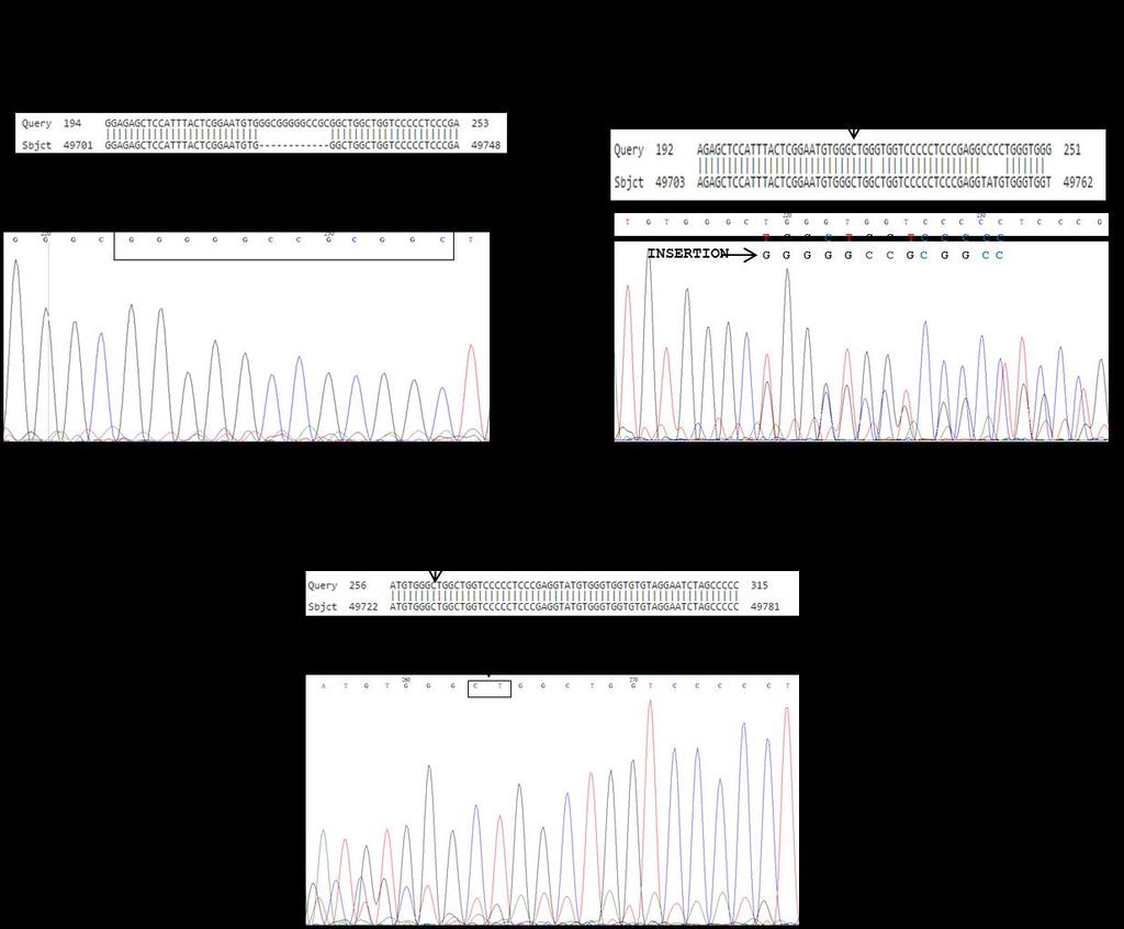 Figure 3 - Electrophoresis profile in agarose gel 3% of PCR of the bovine PRNP gene; 1 = base pair standard; 2 = characteristic band of homozygoous animal with bp deletion; 3 = characteristic band of