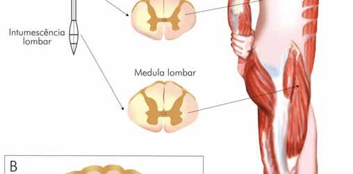 (cervical e lombar).