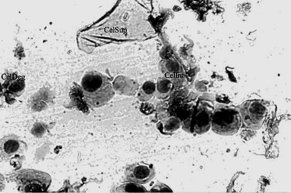 CelInt: Célula Intermediária; CelFoam: Célula de Foam; CelMet: Célula do Metaestro; Leuc: Leucócito. Figura 4 - Citologia esfoliativa característica da fase de estro.