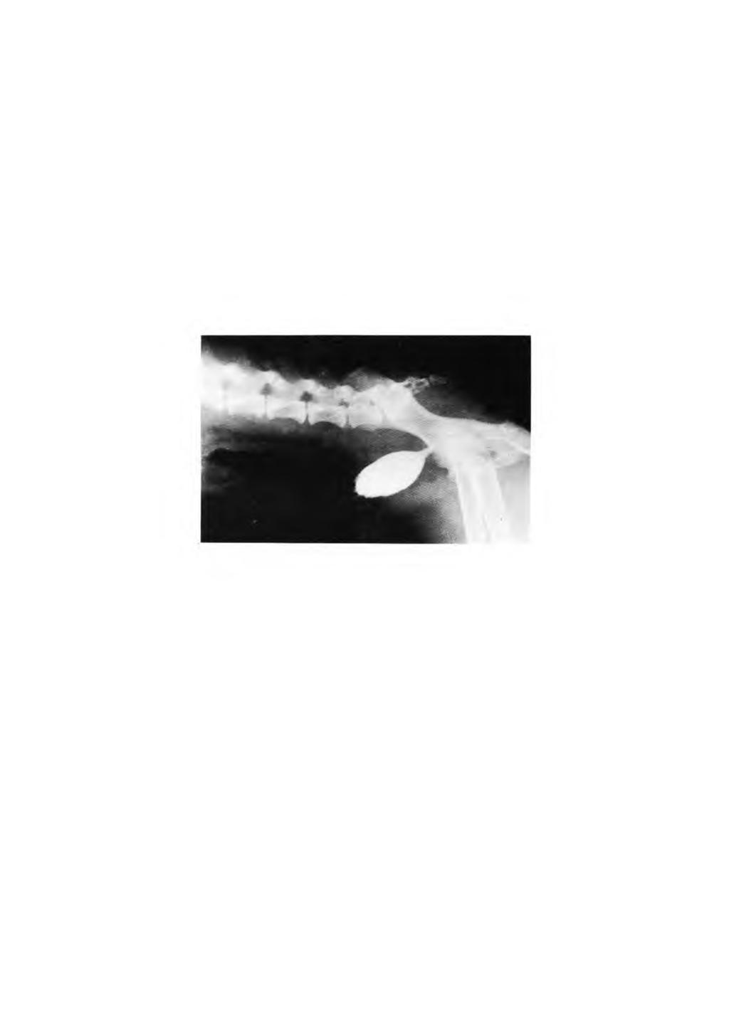 FIGURA 1 - Cistografia mostrando irregularidade da superfície