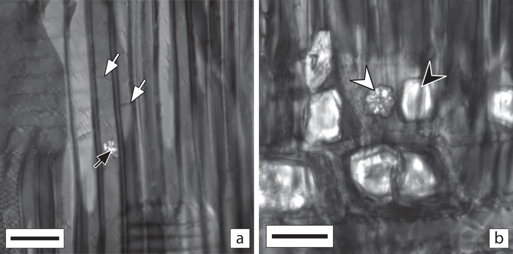 Longui et al.: Caracterização do lenho de Pittosporum undulatum 43 Figura 6. Secções radiais. a. Aglomerado de cristais no lume de uma fibra (seta preta); fibras septadas (setas br
