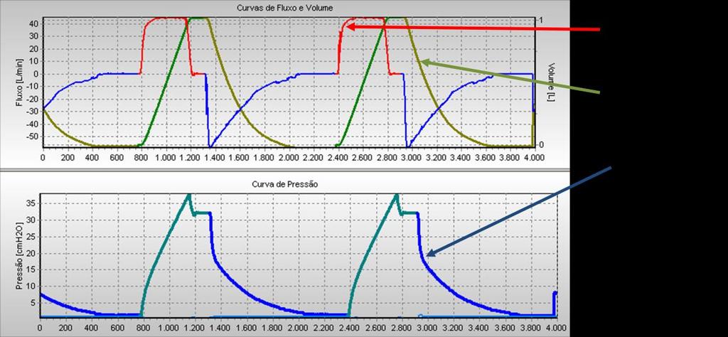 Figura 374 Controle de volume com um volume corrente de