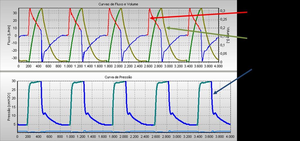 20 e PEEP de 5 cmh 2 O.