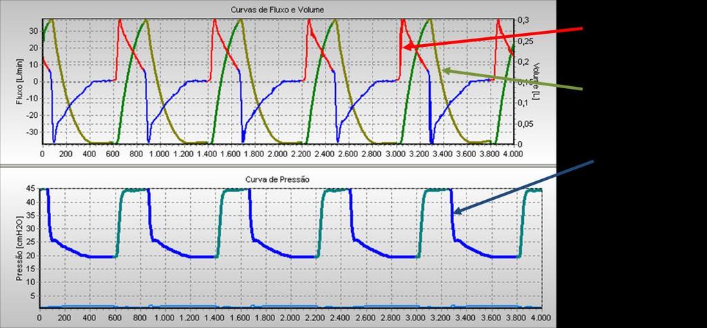 35 e PEEP de 20 cmh 2 O.