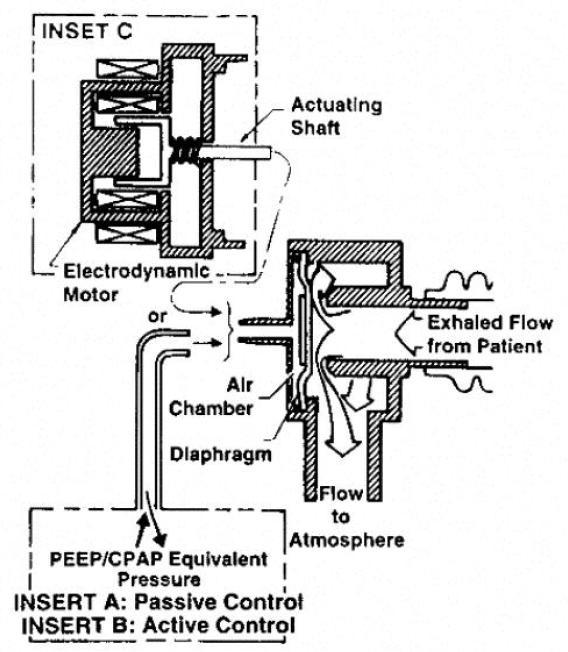 Capítulo 1 -. INTRODUÇÃO Figura 25 Representação da válvula de tesoura. A válvula utilizada neste desenvolvimento usa um diafragma para controlar a pressão no circuito respiratório.