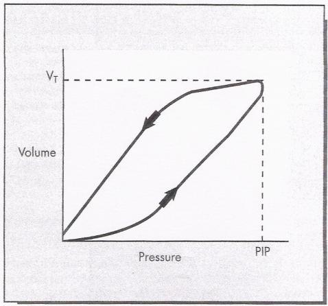 Capítulo 2 - DESCRIÇÃO DO PROBLEMA Figura 40 Gráficos de LOOP típicos. A esquerda Volume por Pressão e a direita Fluxo por Volume.