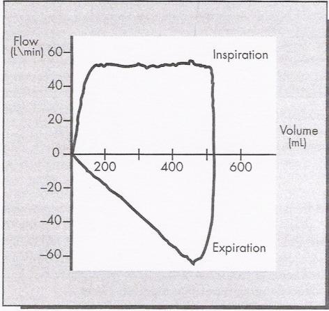 , 2005). A Figura 41 e a Figura 42 mostram a variação na curva de volume por pressão.
