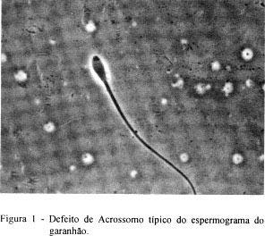 Anormalidades de acromossomo e fertilidade em um garanhão: Relato de um caso.