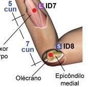 H4 [8] = ID8 Intestino Delgado (Yang) - Intestino Delgado, Olhos e Língua H4 8 (ID8) Sedação Enxaquecas, inflamação da região inferior do abdômen, torcicolos,