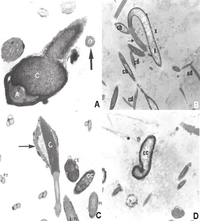557 Figura 2 - A: Cabeça de espermatozóide de galo do tipo arredondada (patologia morfológica), com cromatina escura (C), acrossoma irregular (A) e cortes transversais de caudas em diferentes alturas