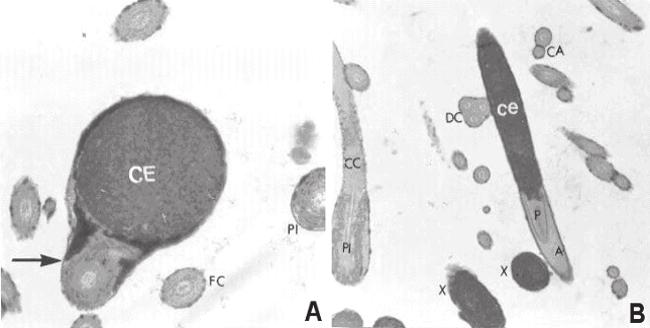 558 Figura 3 - A: Cabeça de espermatozóide de galo em corte transversal com cromatina escura (CE) e cauda dobrada sobre a mesma (patologia morfológica) (seta), sendo possível à visualização de caudas