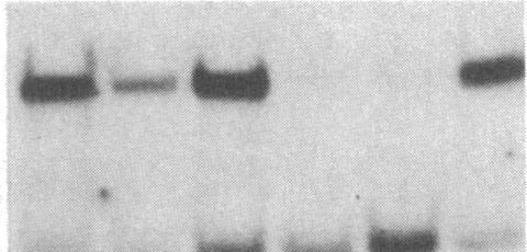 Análise por Northern-blot dos níveis de RNAm da glicogénio fosforilase do
