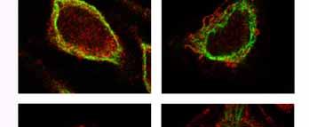 Nas células CI os microtúbulos estão unidos e a PLD2 não se