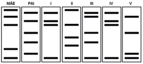 F4 seria um filho adotivo, tanto seu DNA materno quanto o paterno são diferentes de Mãe e Pai. EXERCÍCIO: A figura abaixo representa o resultado de um teste de paternidade.