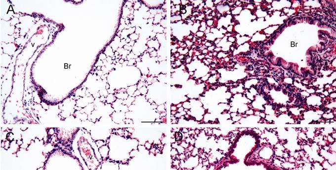 Apêndice Figure 02 - The microphotographs show H&E stained