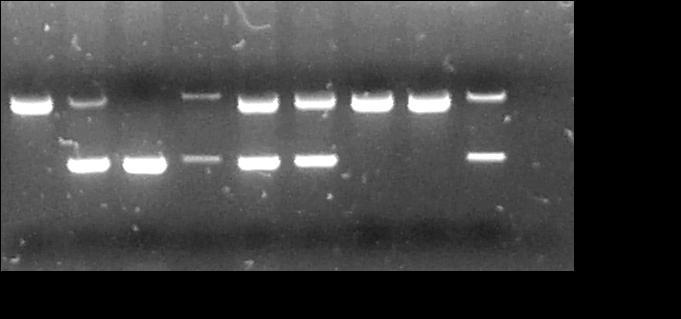 Figura 14. GAP-PCR para deteção da deleção (δβ) 0 Spanish.