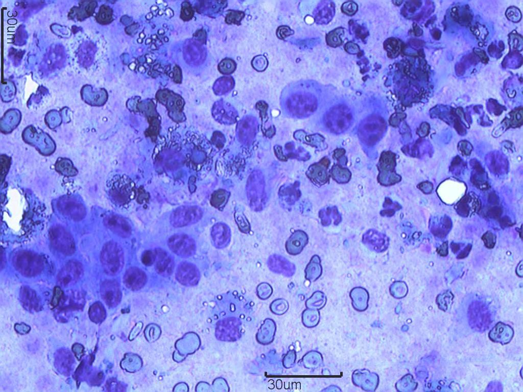 33 Figura 4: Fotomicrografia de células epiteliais de um carcinoma mamário canino (objetiva 40x).