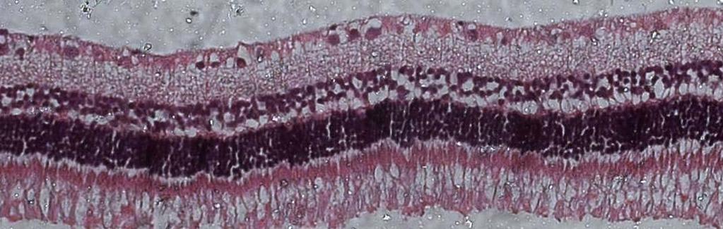 magnificação 20X) Figura 7- Microscopia óptica de retina do grupo de 2,5mg.   magnificação 20X)