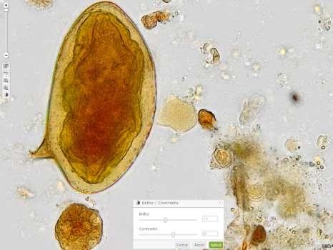 Parasitologia Schistosoma mansoni (3) Imagem 1 ampliada em 800x, sem ajuste do brilho e contraste.