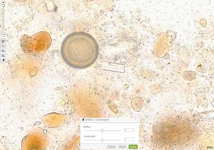 pode ajustar conforme seu critério, permitindo uma melhor visualização das estruturas