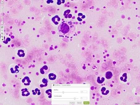 Veterinária Uso das Ferramentas nos Ensaios de Proficiência por Imagem Hemoparasitologia Canino Leishmania sp. (1) Imagem digitalizada com aumento de 1000x, sem ajuste do brilho e contraste.