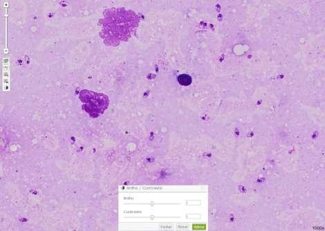 Hemoparasitologia Leishmania sp (1) Imagem digitalizada com aumento de 1000x, sem ajuste do brilho e contraste.