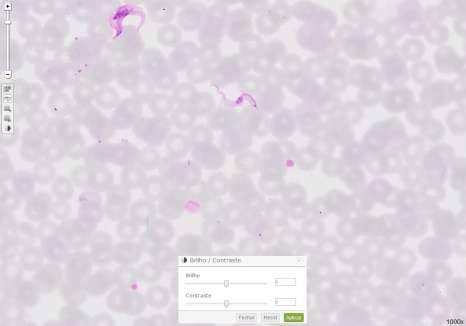 Hemoparasitologia Trypanosoma brucei (1) Imagem digitalizada com aumento de 1000x, sem