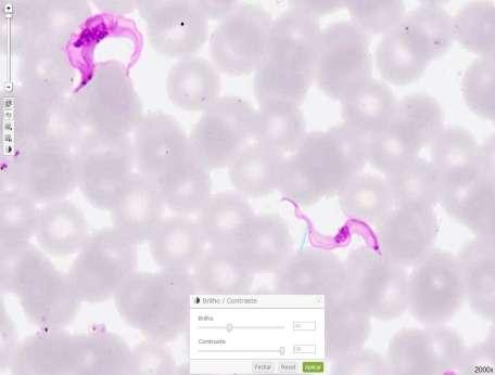 Trypanosoma brucei Clínico Hemoparasitologia (3) Imagem 1 ampliada em 2000x, sem ajuste do brilho e contraste.