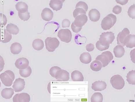 Hemoparasitologia Trypanosoma cruzi (3) Imagem 1 ampliada em 2000x, sem ajuste do brilho e contraste.