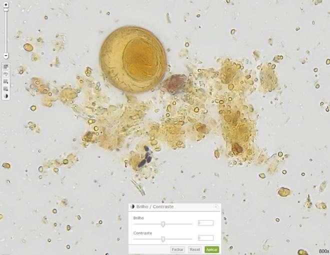 Hymenolepis nana Clínico Parasitologia (3) Imagem 1 ampliada em 800x, sem ajuste do brilho e contraste.