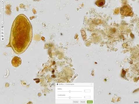 Schistosoma mansoni Clínico Parasitologia (1) Imagem digitalizada com aumento de 400x, sem ajuste do brilho e contraste.