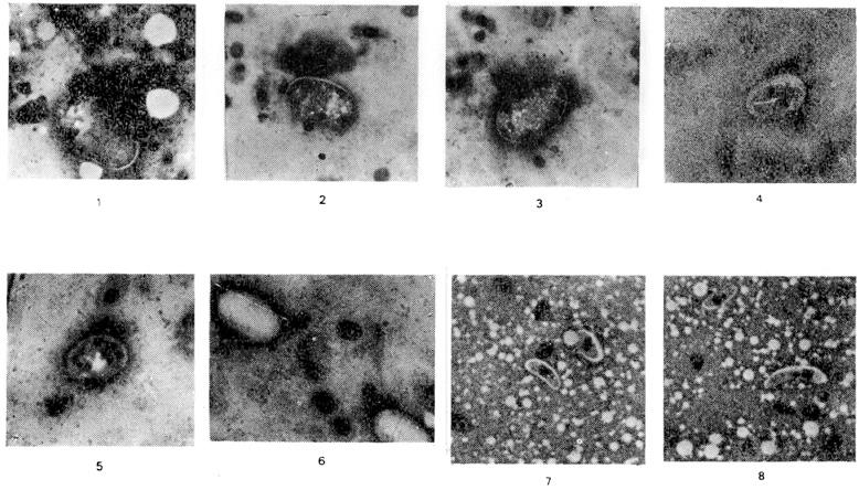 para um dos lados ou extremidade (Fotos 9 a 12). A prevalência da infecção no sangue, entre os 112 exemplares do T.